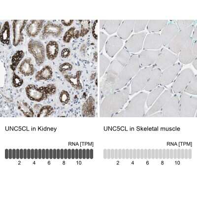 Immunohistochemistry-Paraffin: UNC5CL Antibody [NBP2-47585]