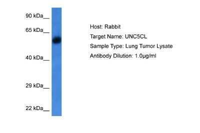 Western Blot: UNC5CL Antibody [NBP2-86040]