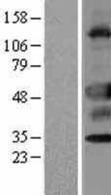 Western Blot: UNC5CL Overexpression Lysate [NBP2-05117]