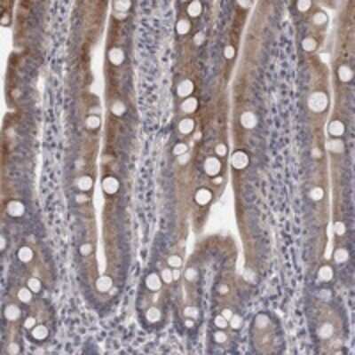 Immunohistochemistry-Paraffin: UNC5H2/UNC5B Antibody [NBP3-17778]