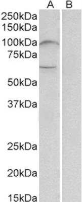 Western Blot: UNC5H2/UNC5B Antibody [NBP2-42523]