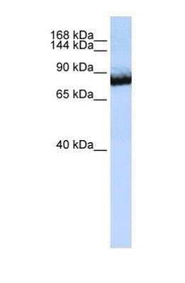 Western Blot: UNC5H3/UNC5C Antibody [NBP1-69283]