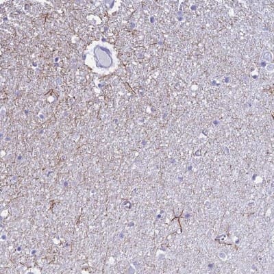 Immunohistochemistry-Paraffin: UNC80 Antibody [NBP1-94110]