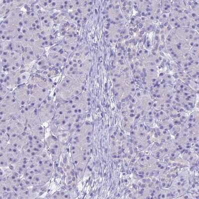 Immunohistochemistry-Paraffin: UNC80 Antibody [NBP1-94110]