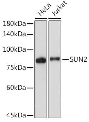 Western Blot: UNC84B Antibody (8E8D7) [NBP3-15912]