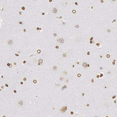 Immunohistochemistry-Paraffin: UNC84B Antibody [NBP2-62573]