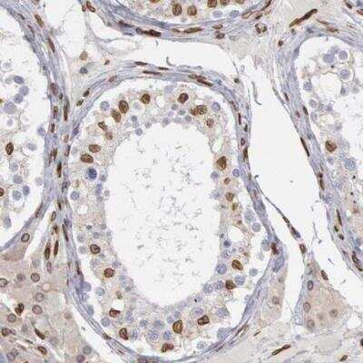 Immunohistochemistry-Paraffin: UNC84B Antibody [NBP2-62573]