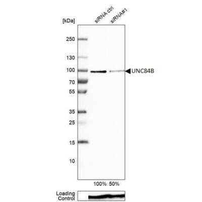 Western Blot: UNC84B Antibody [NBP2-62573]