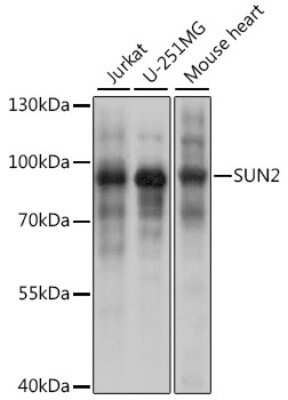 Western Blot: UNC84B AntibodyAzide and BSA Free [NBP2-93720]