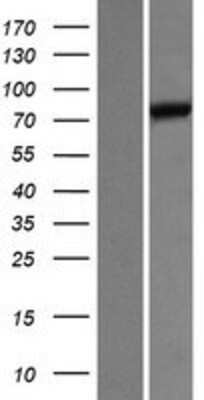 Western Blot: UNC84B Overexpression Lysate [NBP2-07182]