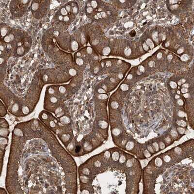 Immunohistochemistry-Paraffin: UNC93A Antibody [NBP1-90576]