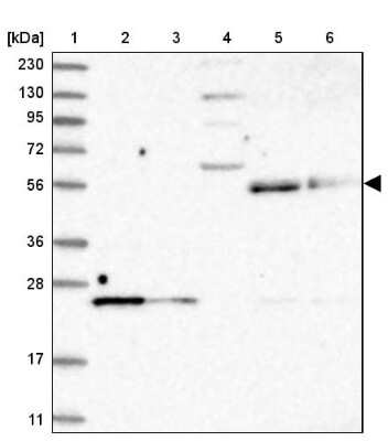 Western Blot: UNC93A Antibody [NBP1-90576]