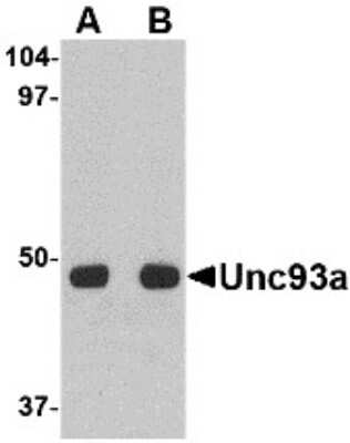 Western Blot: UNC93A AntibodyBSA Free [NBP2-81858]