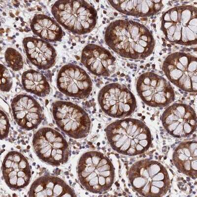 Immunohistochemistry-Paraffin: UNC93B Antibody [NBP2-13507]
