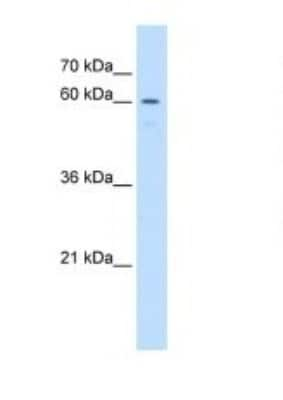 Western Blot: UNCX Antibody [NBP1-91314]