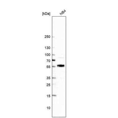 Western Blot: UNCX Antibody [NBP2-56480]