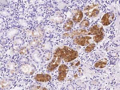 Immunohistochemistry-Paraffin: UNG Antibody [NBP2-98838]