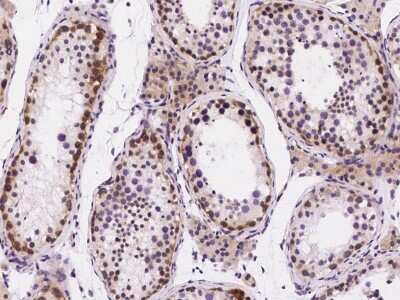 Immunohistochemistry-Paraffin: UNG Antibody [NBP2-98838]