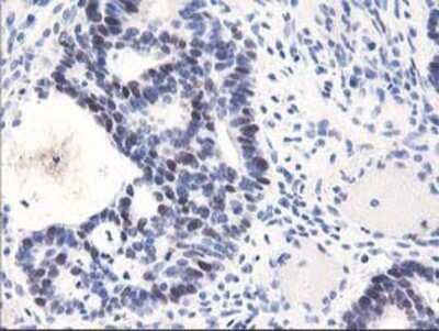 Immunohistochemistry: UNG Antibody (OTI1A11) - Azide and BSA Free [NBP2-74785]