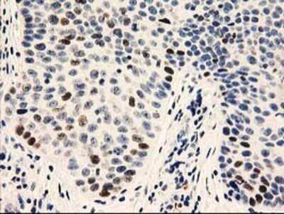 Immunohistochemistry: UNG Antibody (OTI1A11) - Azide and BSA Free [NBP2-74785]