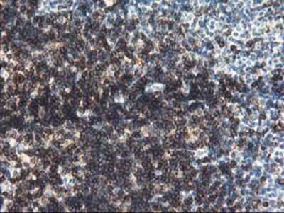 Immunohistochemistry: UNG Antibody (OTI1A11) - Azide and BSA Free [NBP2-74785]