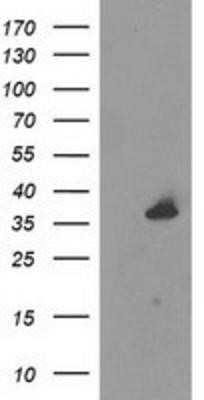 Western Blot: UNG Antibody (OTI1A11)Azide and BSA Free [NBP2-74785]