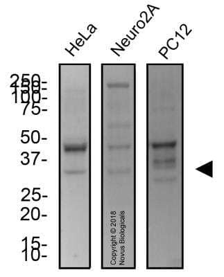 Western Blot: UNG Antibody [NB600-1031]