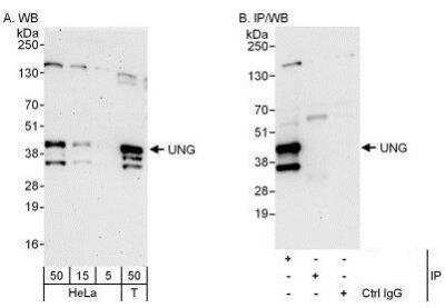 Western Blot: UNG Antibody [NBP1-49985]