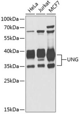 Western Blot: UNG AntibodyBSA Free [NBP2-93120]