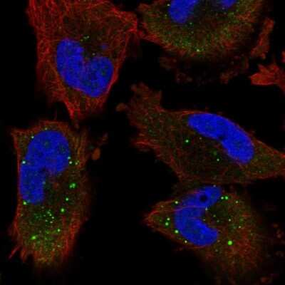 Immunocytochemistry/ Immunofluorescence: UNK Antibody [NBP1-89595]