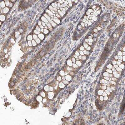 Immunohistochemistry-Paraffin: UNK Antibody [NBP1-89596]