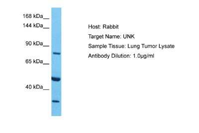 Western Blot: UNK Antibody [NBP2-86041]