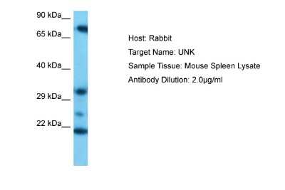 Western Blot: UNK Antibody [NBP2-86042]