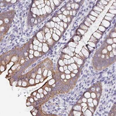 Immunohistochemistry-Paraffin: UNKL Antibody [NBP2-33766]