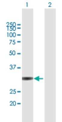 Western Blot: UNKL Antibody [H00064718-B01P]