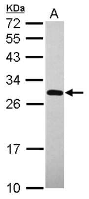 Western Blot: UNKL Antibody [NBP2-15156]