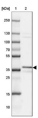 Western Blot: UNKL Antibody [NBP2-33766]