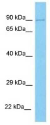 Western Blot: UNKL Antibody [NBP3-10277]