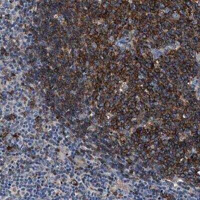 Immunohistochemistry-Paraffin: UNQ6411 Antibody [NBP1-90648]