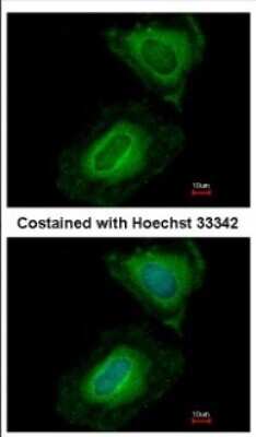 Immunocytochemistry/ Immunofluorescence: UPF2 Antibody [NBP2-20813]