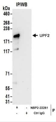 Immunoprecipitation: UPF2 Antibody [NBP2-22281]