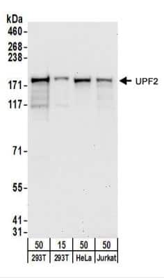 Western Blot: UPF2 Antibody [NBP2-22281]