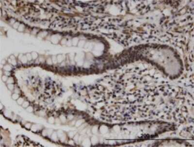 Immunohistochemistry-Paraffin: UPF3A Antibody (2E2) [H00065110-M06]