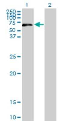 Western Blot: UPF3A Antibody (2E2) [H00065110-M06]