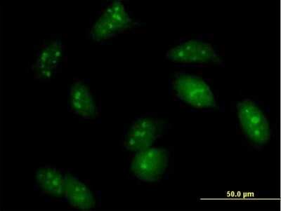 Immunocytochemistry/ Immunofluorescence: UPF3A Antibody [H00065110-B01P]