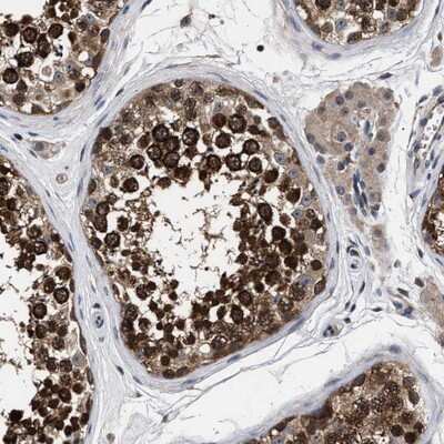 Immunohistochemistry-Paraffin: UPF3A Antibody [NBP1-83136]