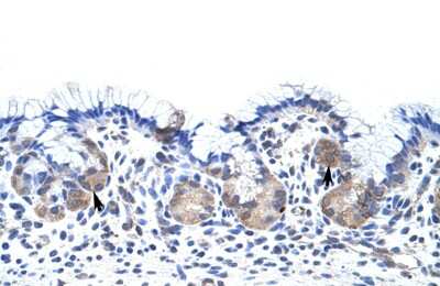 Immunohistochemistry-Paraffin: UPF3B Antibody [NBP1-57232]
