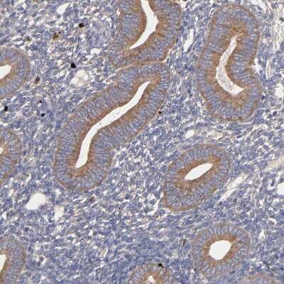 Immunohistochemistry-Paraffin: UPF3B Antibody [NBP1-83134]