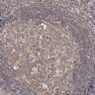 Immunohistochemistry-Paraffin: UPF3B Antibody [NBP1-83134]