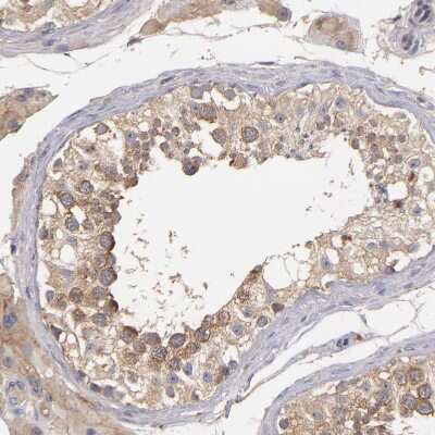 Immunohistochemistry-Paraffin: UPF3B Antibody [NBP1-83134]